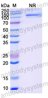 Валидация SDS-PAGE - AntibodySystem DHF92405