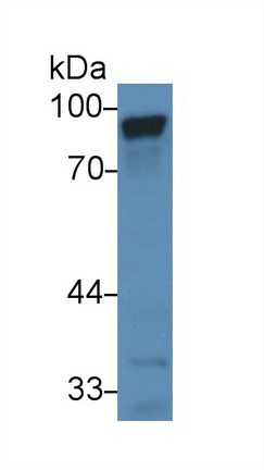 14917