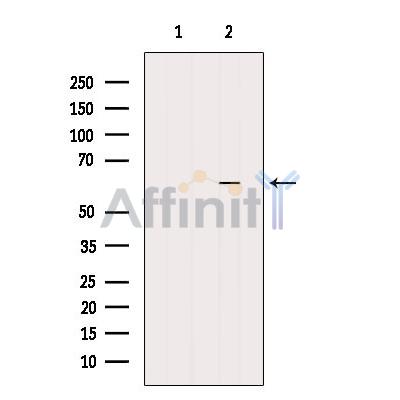 Валидация Affinity AF6168 - 3386