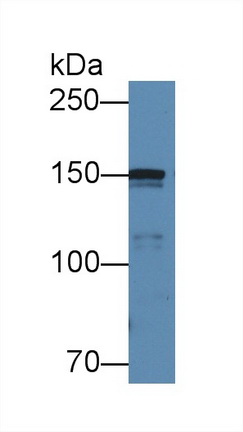 12591