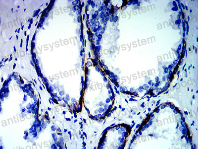 Валидация AntibodySystem RHC99404 (1246)