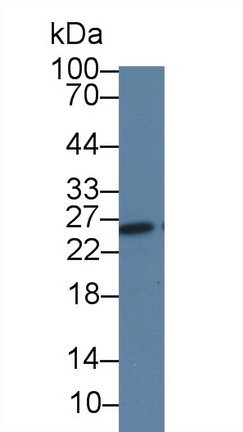 28363