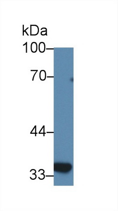 12384