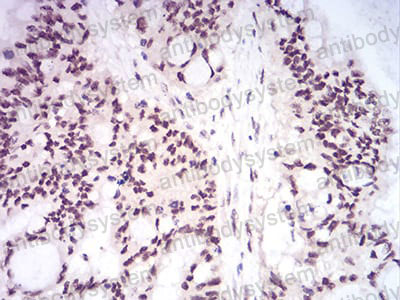 Валидация AntibodySystem RHD69905 (1734)