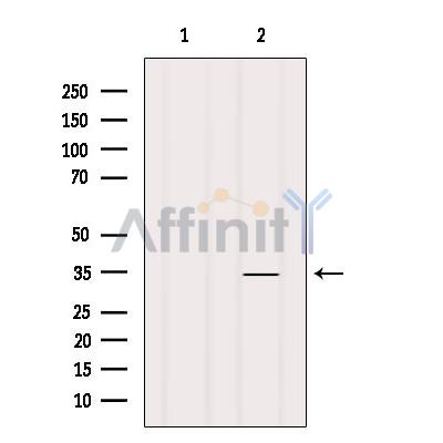 Валидация Affinity DF10241 - 5825
