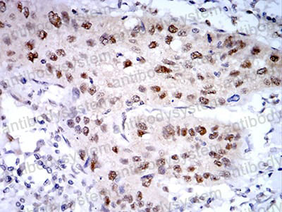 Валидация AntibodySystem RHD27502 (1454)