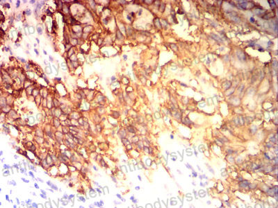 Валидация AntibodySystem RHD17408 (1393)