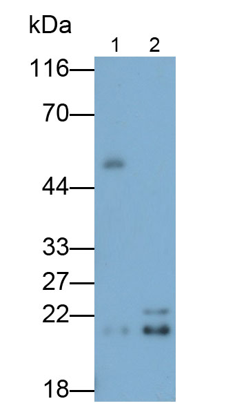 12774