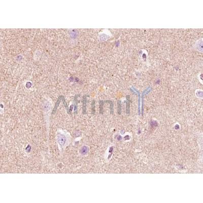 Валидация Affinity AF5172 - 2592