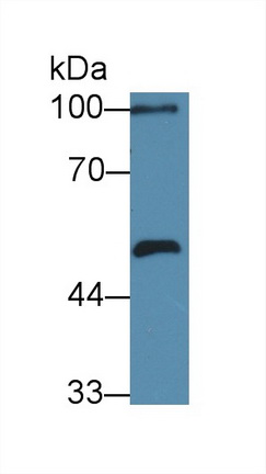 12317