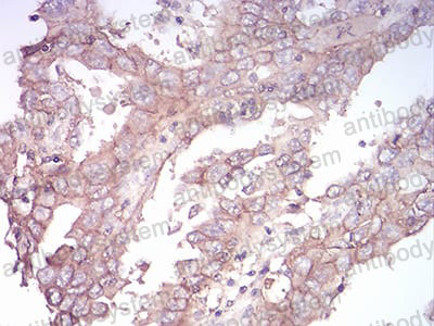 Валидация AntibodySystem RHK41802