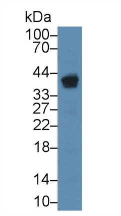 12871