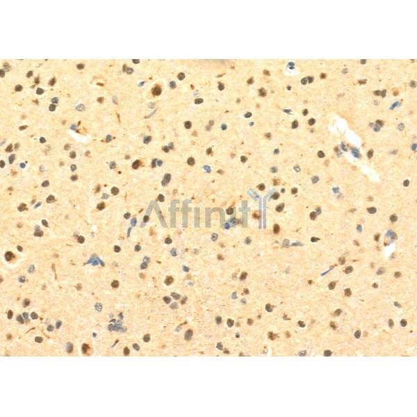 Валидация Affinity DF6924 - 18525
