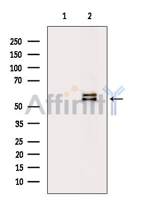 Валидация Affinity AF6922 - 4115