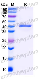Валидация SDS-PAGE - AntibodySystem RHD36901