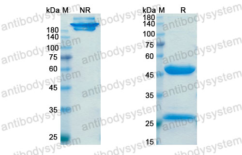Валидация SDS-PAGE - AntibodySystem DHD17204