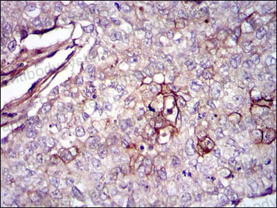 Валидация AntibodySystem RHC00804 (536)