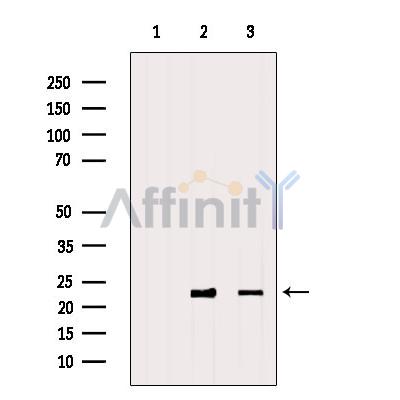 Валидация Affinity DF2957 - 13704