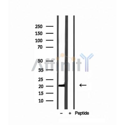 Валидация Affinity DF12120 - 6263