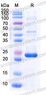 AHJ70901, SDS-PAGE