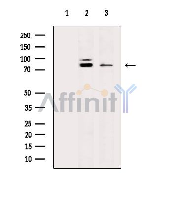 Валидация Affinity DF15215 - 11487
