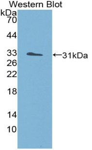 55782