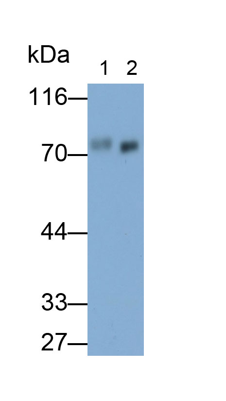 31824