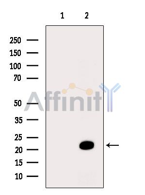 Валидация Affinity DF14285 - 10156