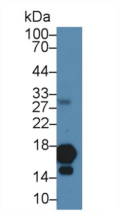 17589