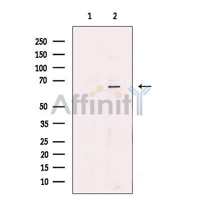 Валидация Affinity DF13649 - 9203
