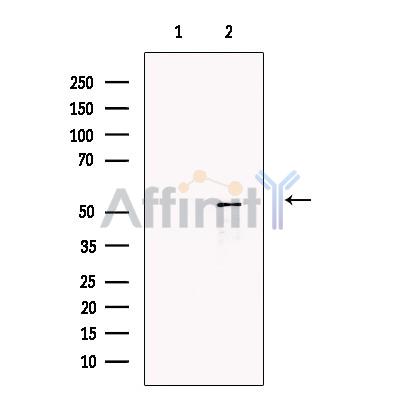 Валидация Affinity DF13406 - 8687