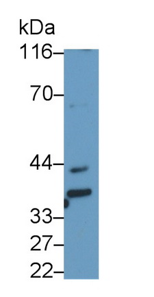53311
