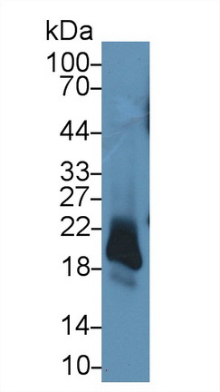 14752