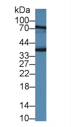 14384