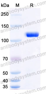 AHD48404, SDS-PAGE