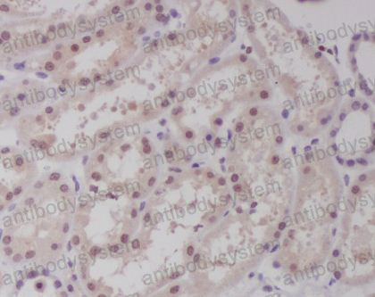 Валидация AntibodySystem RHB20602 (284)