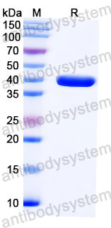 Валидация SDS-PAGE - AntibodySystem RVV14704