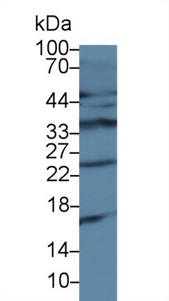 13888