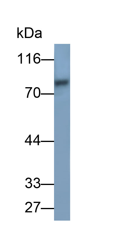 31655