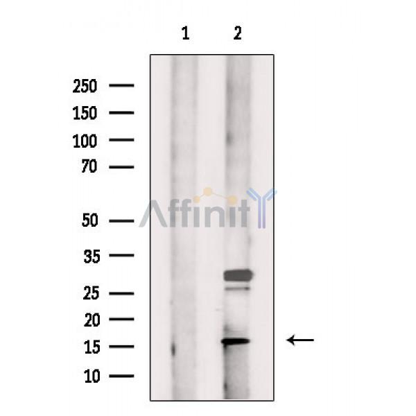 Валидация Affinity DF3649 - 14634
