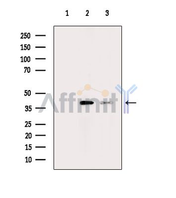Валидация Affinity DF14907 - 11065