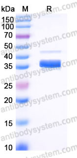 EHB79901, SDS-PAGE