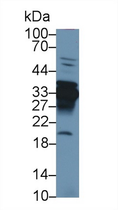 13315