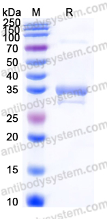YHE75301, SDS-PAGE