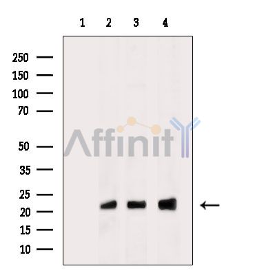 Валидация Affinity DF15548 - 11949