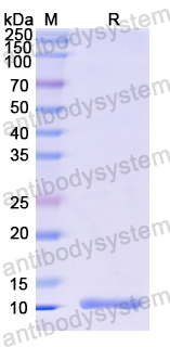 YXX08001, SDS-PAGE