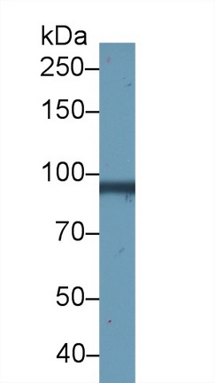 14851