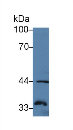 14206