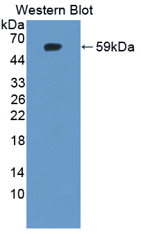 57174