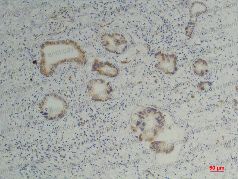 Валидация AntibodySystem RHD56504
